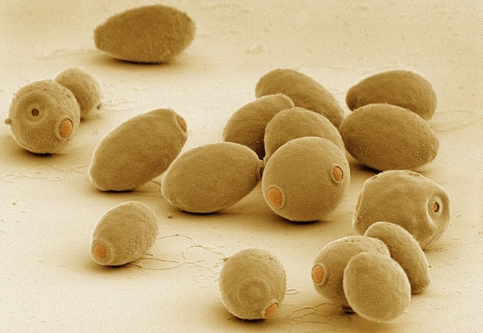 Technical article - What is Yeast? Yeast infections causes and risk factors
