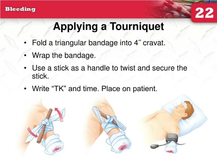 TacMed SOF® TOURNIQUET » Concealed Carry Inc Tourniquet for first aid kit