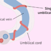 Belly Button Leaking Fluid Causes & Solutions