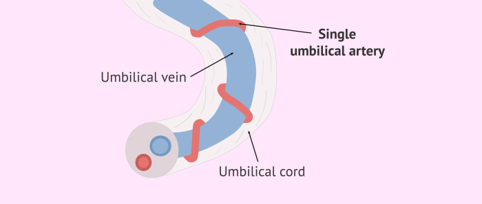 Umbilical Cord Blood Banking Market 2025: Impact of Electrification and Grid Integration Belly button leaking fluid
