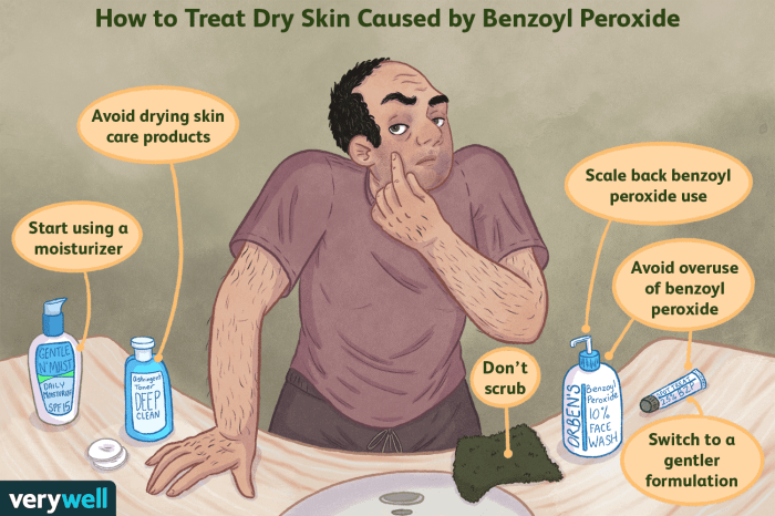 Tips for using benzoyl peroxide