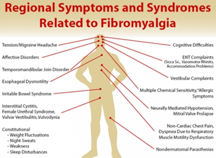 Fibromyalgia primary or secondary