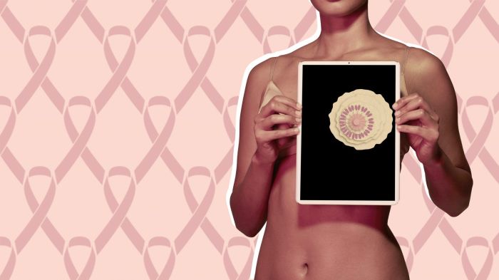 Triple negative breast cancer recurrence after mastectomy