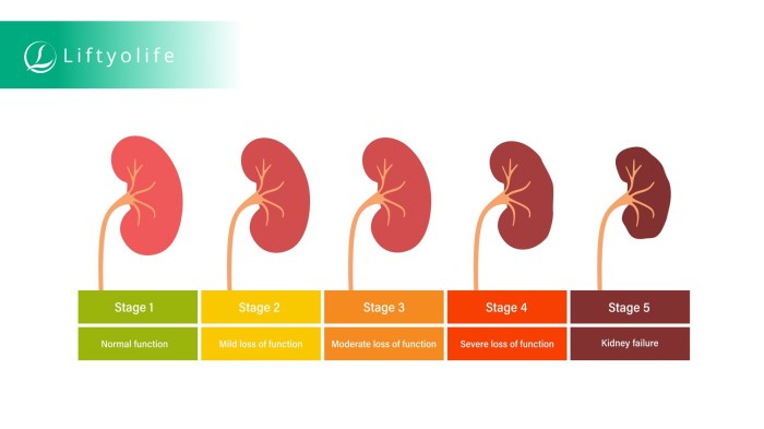 chronic-kidney-disease-stage-3 – Liftyolife Chronic kidney disease life expectancy