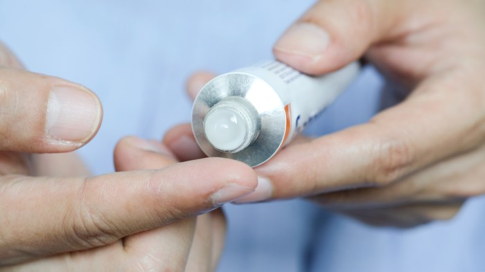 Steroids topical steroid strengths