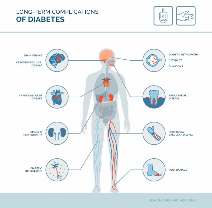 Type 2 Diabetes Complications: Overview and More Diabetes and intermittent fasting