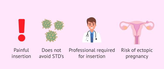 What Is an IUD? Here's Everything You Need to Know Pros and cons of iud