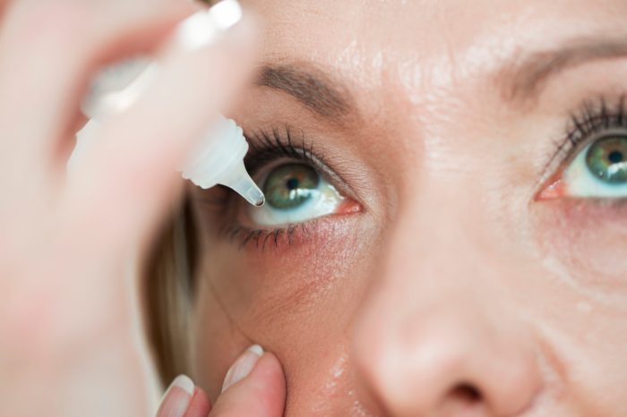 How to Cure Dry Eyes A Comprehensive Guide