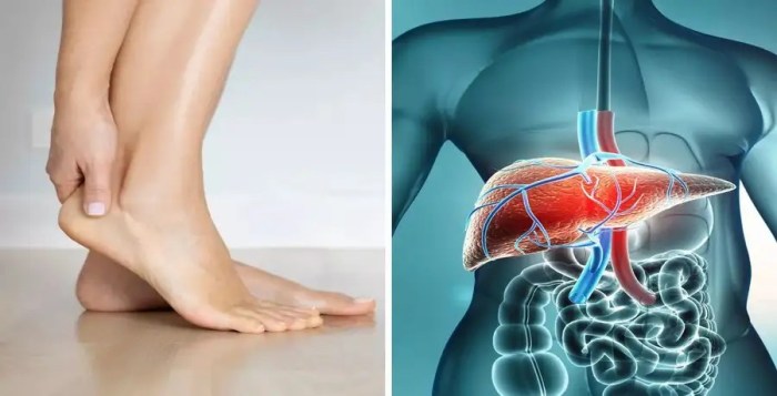 Itchy Hands and Feet Causes and Solutions
