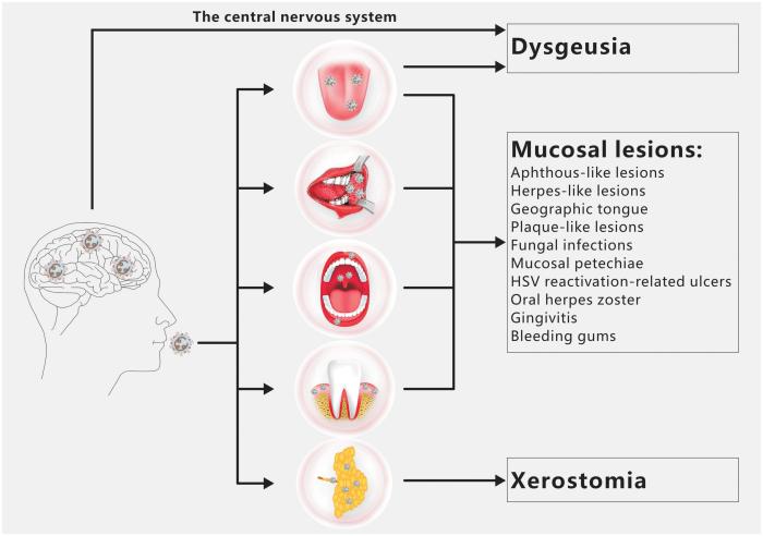 Symptoms of Oral Cancer Mouth swab drug test