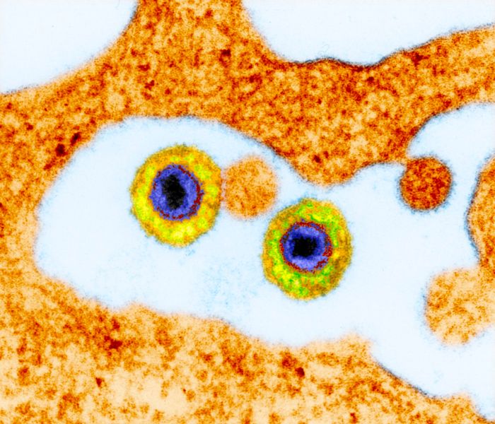 Hhv 6 and its role in disease