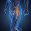 Hip Labrum Surgery Is It the Right Treatment?