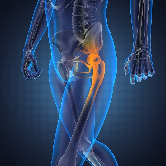 Hip Labrum Surgery Is It the Right Treatment?