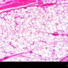 What is Adipose Tissue A Deep Dive