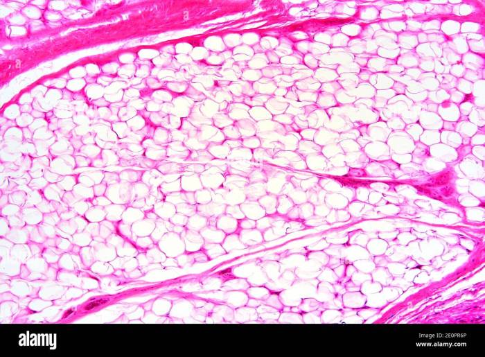 What is adipose tissue