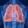 Lung Cancer with EGFR Mutation A Comprehensive Guide