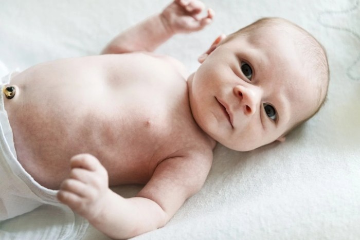 How To Care for a Newborn's Umbilical Cord - Sunshine Billingual The Blog Belly button leaking fluid