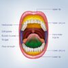 What is Oral Cancer A Comprehensive Guide