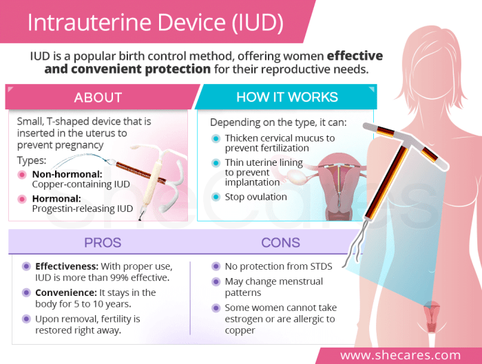 Pros and cons of iud