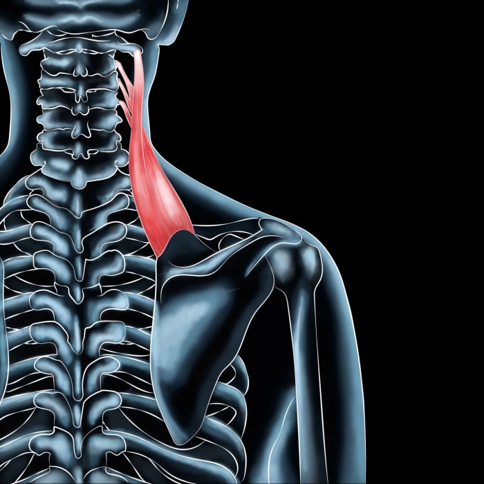 Treating Trigger Points in the Levator Scapulae | Dry Needling, Levator ... What is levator ani syndrome