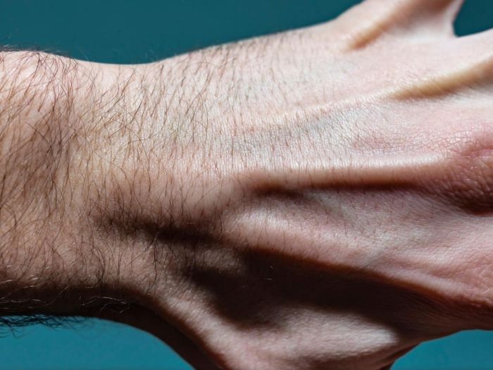 Bumps on wrist- what are they? : r/Dermatology Hand and wrist lumps and bumps