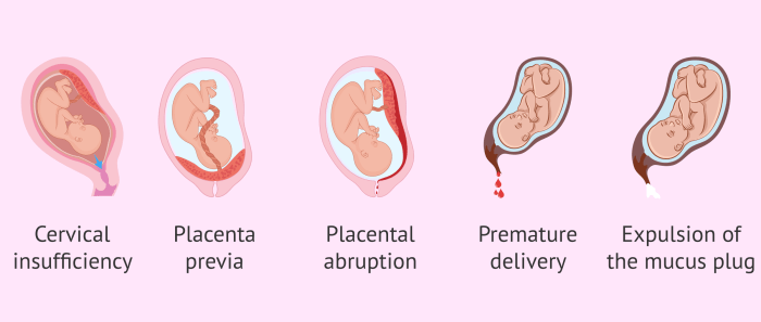 Pregnancy massage benefits contraindications and safety