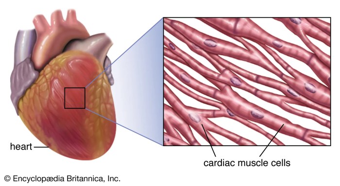 Cardiac Arrest Vs Heart Attack Vector Illustration Ve - vrogue.co Cardiac resynchronization therapy crt