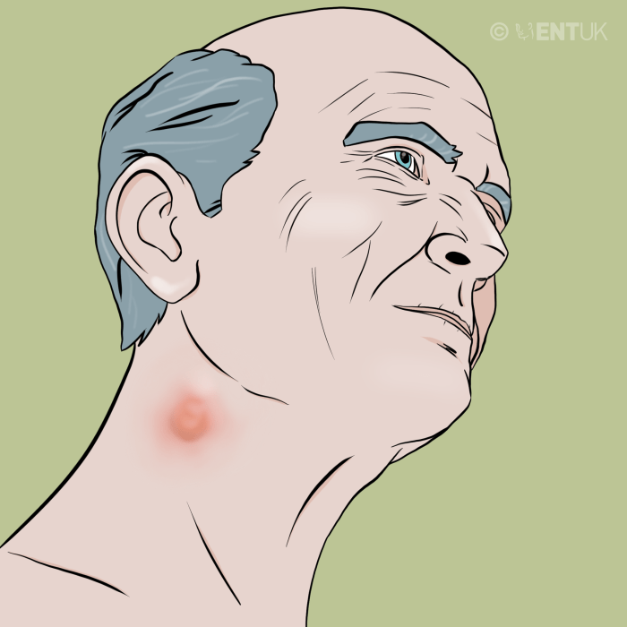 Lump under skin causes and when to worry