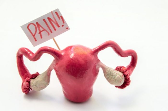 Ovary pain causes and treatment