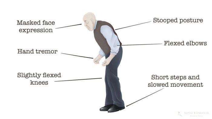 Gait Gait training in physical therapy