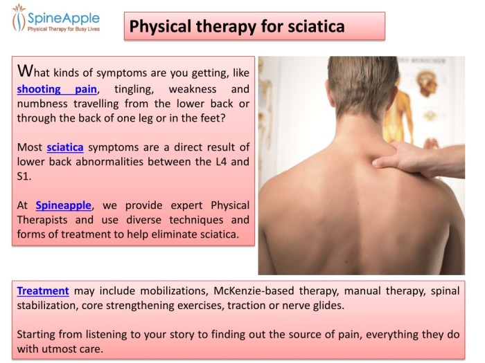 Physical Therapy for Sciatica A Comprehensive Guide