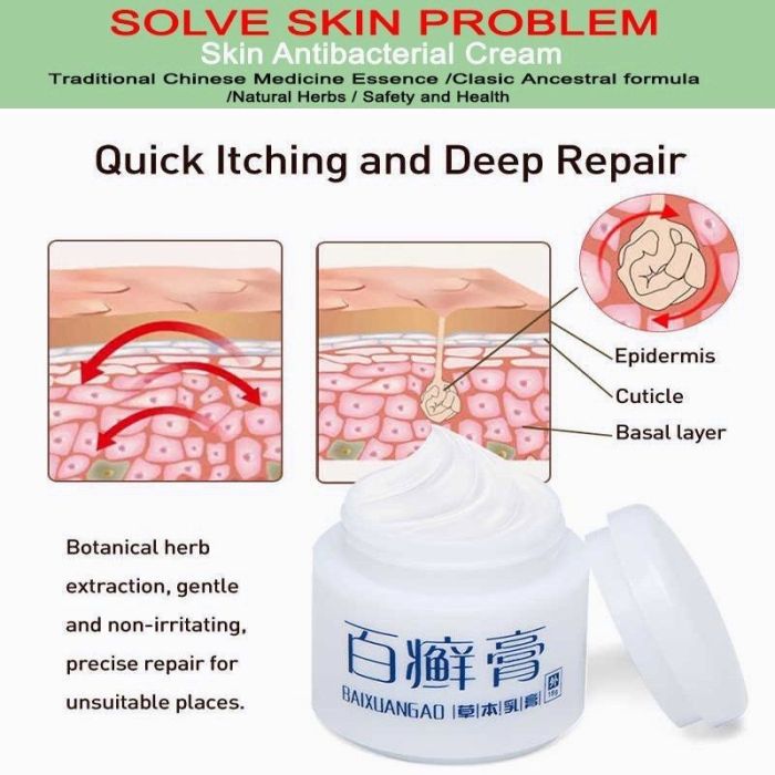 Treating psoriasis on your hands and feet