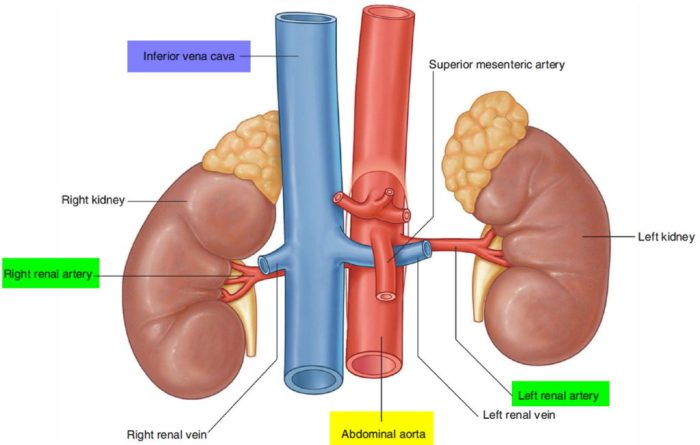 What is Renal Artery Stenosis? A Deep Dive