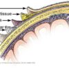 Scalp Psoriasis vs Dandruff A Comprehensive Guide
