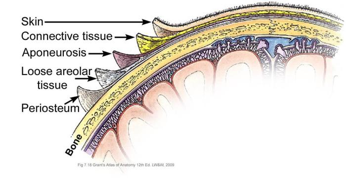 Scalp psoriasis vs dandruff