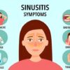 Are Sinus Infections Contagious? Understanding the Risks