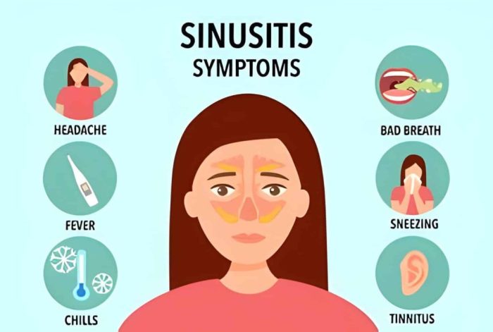 Are Sinus Infections Contagious? - Houston Advanced Sinus Are sinus infections contagious