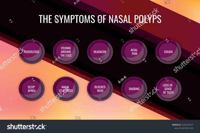 Nasal Polyps: Symptoms, Treatment, and More Nasal polyps symptoms dizzy