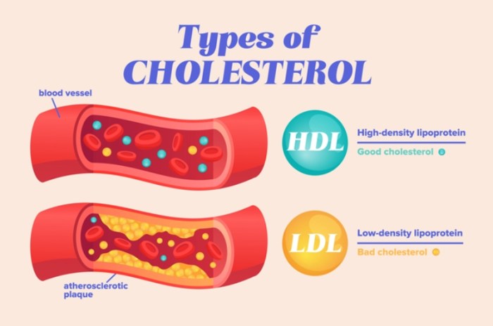 Cholesterol heart disease and african americans