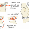 What is TMJ Disorder? A Deep Dive