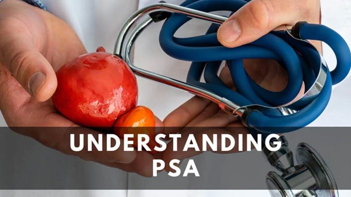 What Does a High PSA Level Test Result Mean? Understanding your psa results