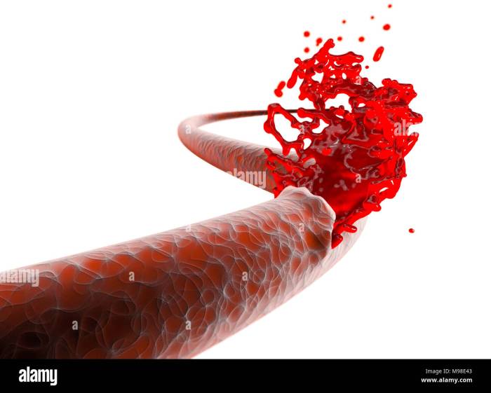 Blood flow through the heart
