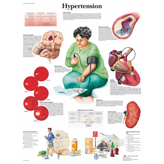 High Blood Pressure (Hypertension) - FastMed All about hypertension diagnosis