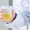 Urine Glucose Test What It Measures, Results, Next Steps
