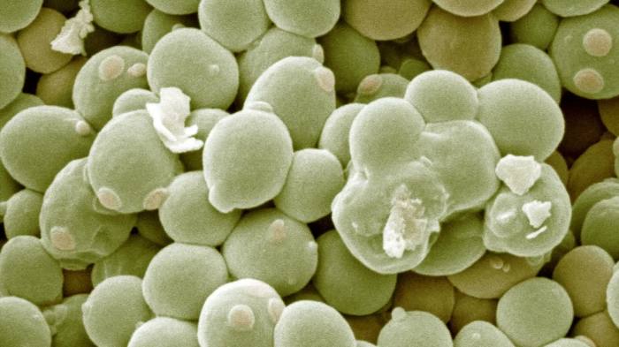 Bread Yeast Yeast infection vs uti