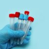 FDA Rule Regulates Specialized Lab Tests