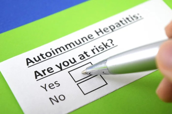 How Autoimmune Hepatitis Is Diagnosed A Comprehensive Guide