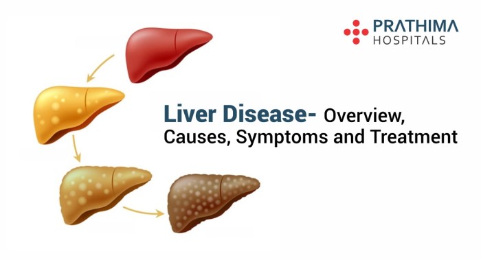 Signs of liver disease