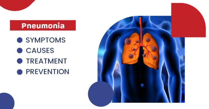 Pneumonia and COVID-19 A Deep Dive