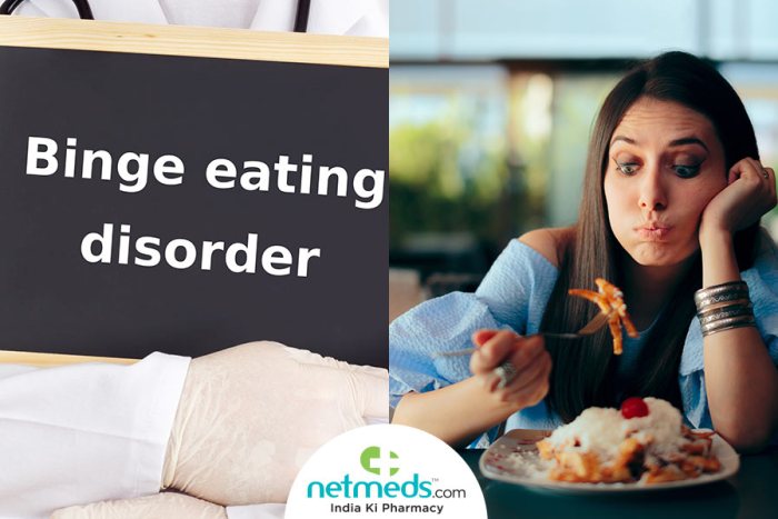Binge eating disorder treatment